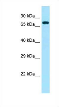 Anti-ZAP70 antibody produced in rabbit