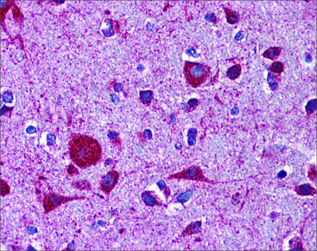 Anti-LRP8 antibody produced in rabbit