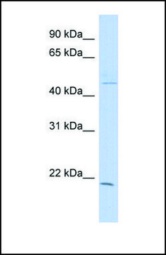 Anti-CIB3, (N-terminal) antibody produced in