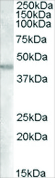 Anti-GOT2 (AA 295-306) antibody produced