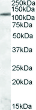 Anti-ERN1/IRE1A antibody produced in goat