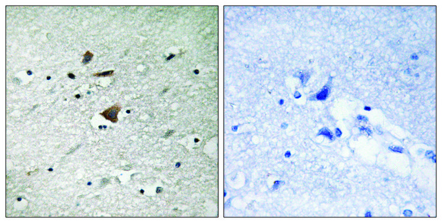Anti-APC1 antibody produced in rabbit