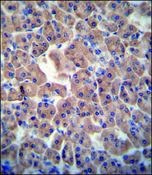 ANTI-ATPBD3 (CENTER) antibody produced in