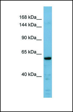 Anti-CDH23 antibody produced in rabbit