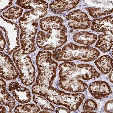 Anti-FAM160A2 antibody produced in rabbit