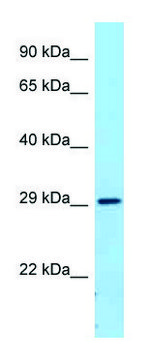 Anti-FCGR2B (C-terminal) antibody produced in