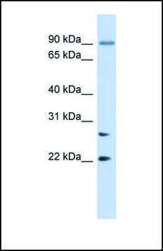 Anti-JOSD2, (N-terminal) antibody produced in