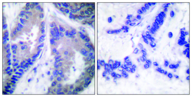 Anti-Collagen ?1 XVIII, C-Terminal antibody