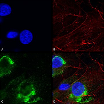 Monoclonal Anti-Lrrk2/Dardarin - Rpe antibody