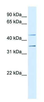 Anti-P2RY1 (N-terminal) antibody produced in