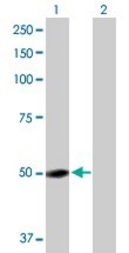 Anti-GC antibody produced in rabbit