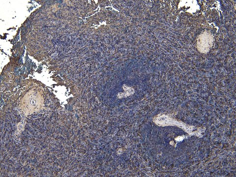 Anti-AIF1/IBA1 (Isoforms 1 and 3)