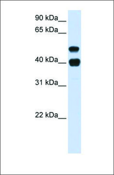 Anti-USP22 (ab1) antibody produced in