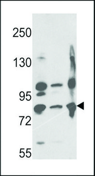 ANTI-NEPRILYSIN(C-TERMINAL) antibody produced in rabbit