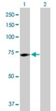 Anti-GALC antibody produced in rabbit