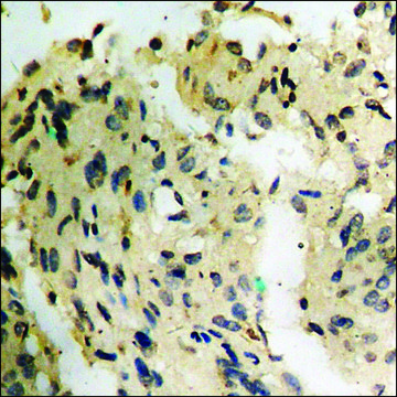 Anti-phospho-ZAP-70 (pTyr??³) antibody produced in