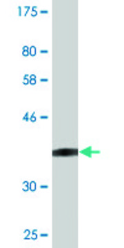 Monoclonal Anti-MEIS3, (N-terminal) antibody produced