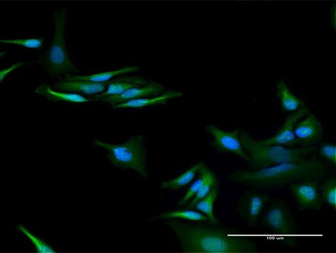 Anti-C13orf18 antibody produced in rabbit