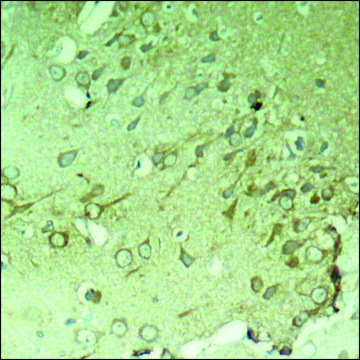 Anti-MAPT (Ab-396) antibody produced in