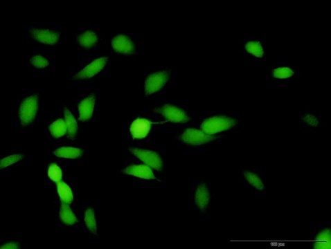 Anti-HMBS antibody produced in rabbit