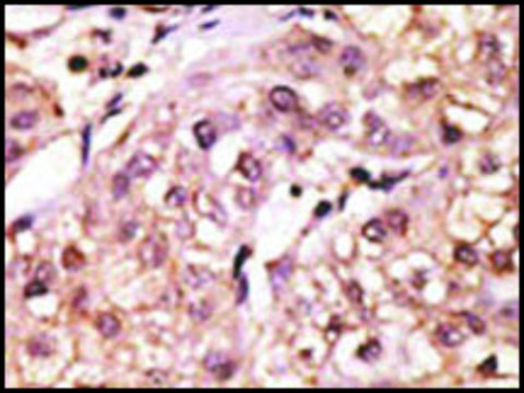 Anti-L29 (N-term) antibody produced in