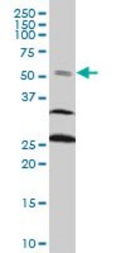 ANTI-FOXC2 antibody produced in mouse