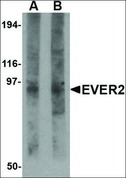 Anti-EVER2 (ab2) antibody produced in