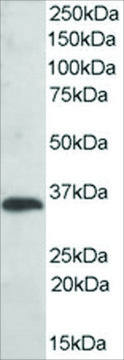 Anti-TXNDC1/TMX antibody produced in goat