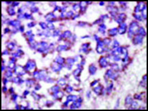 Anti-LATS1 (N-term) antibody produced in