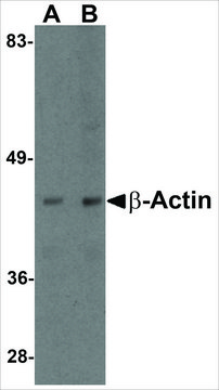 Anti-?-Actin antibody produced in chicken