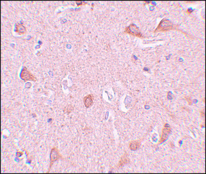 Anti-SIPA1L1 antibody produced in rabbit