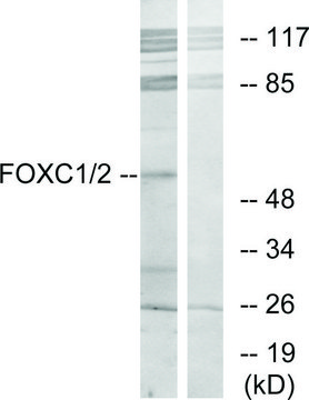Anti-FOXC1 antibody produced in rabbit