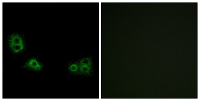 Anti-TMEM185A antibody produced in rabbit