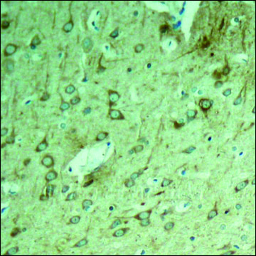 Anti-MAPT (Ab-231) antibody produced in