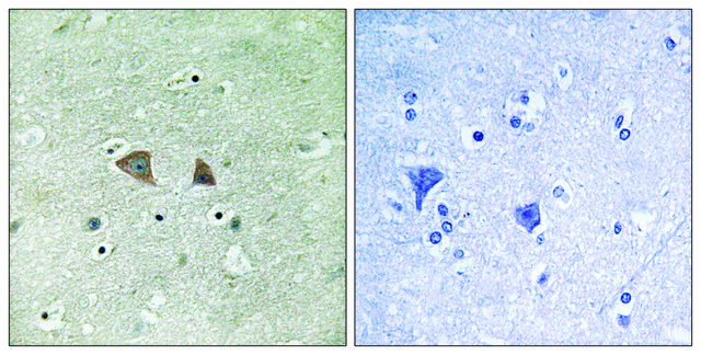 Anti-p70 S6 Kinase, C-Terminal antibody