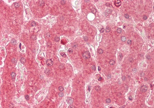 Anti-ALAS1 antibody produced in rabbit