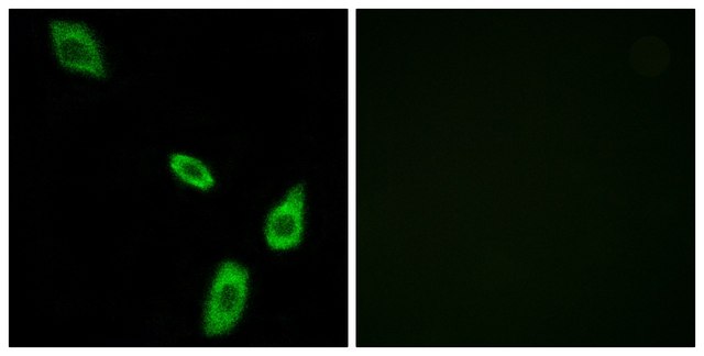 Anti-ADRA1B antibody produced in rabbit