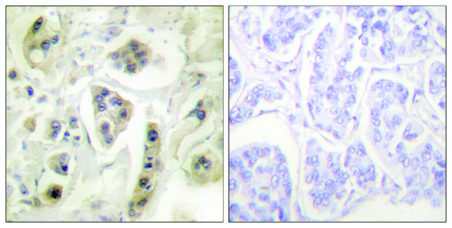 Anti-HSP60 antibody produced in rabbit