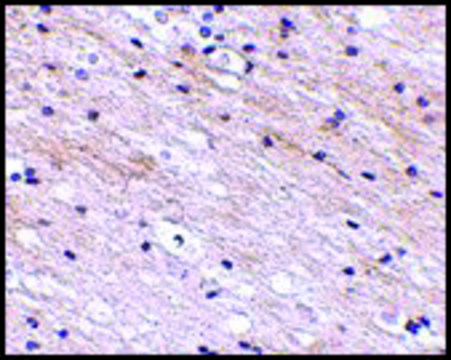 Anti-SATB1 (ab2) antibody produced in