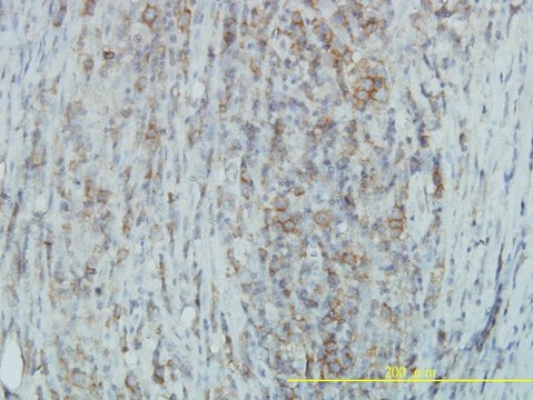Monoclonal Anti-TYK2 antibody produced in