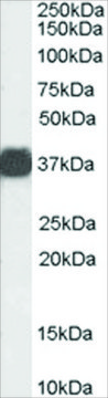 Anti-Arginase, Type 1/ARG1 (AB2) antibody