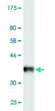 Monoclonal Anti-CAV3, (N-terminal) antibody produced