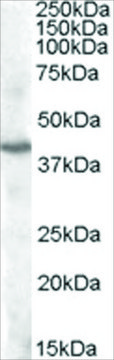 Anti-PITX3 antibody produced in goat