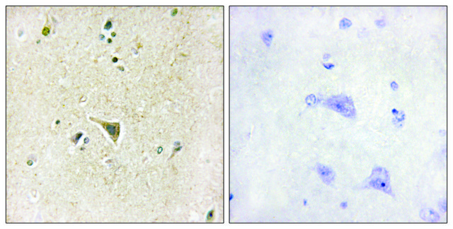 Anti-LRRK1 antibody produced in rabbit