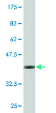 Monoclonal Anti-EXOSC4, (N-terminal) antibody produced