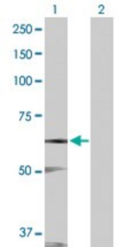 Anti-STK17A antibody produced in rabbit