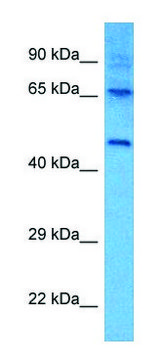 Anti-LTBR (C-terminal) antibody produced in