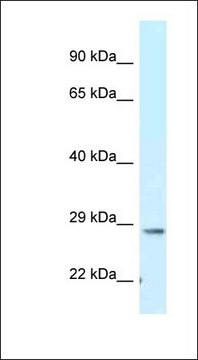 Anti-TMEM106B antibody produced in rabbit
