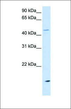 Anti-CETP antibody produced in rabbit