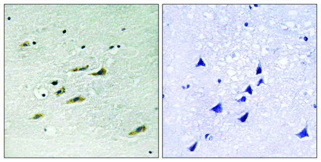 Anti-JAK2 antibody produced in rabbit